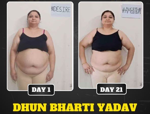Before/After